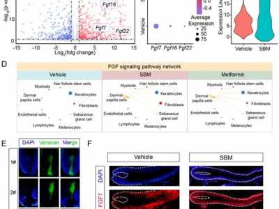 SIPIMO Essence Activates the FGF Pathway in Dermal Papilla Cells to Promote Hair Regrowth